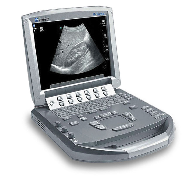 Портативный УЗИ аппарат M-Turbo M-OB/GYN Office Портативный УЗИ аппарат M-Turbo M-OB/GYN Office